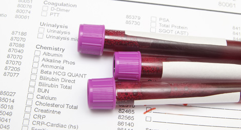 3 full vials of blood on top of a blood test form